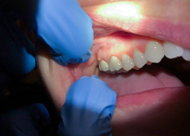 Best Emergency Treatment for Jaw Pain or Injury in Collinsville, MS